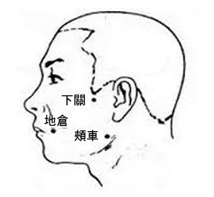 「眼歪嘴斜」很緊張?遇到顏面神經麻痺不要慌,中醫治療成效好